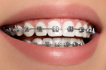 Before treatment