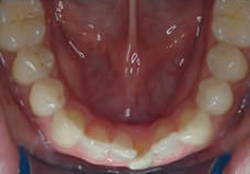 Before treatment