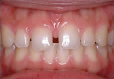 Before treatment