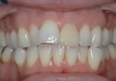 Before treatment